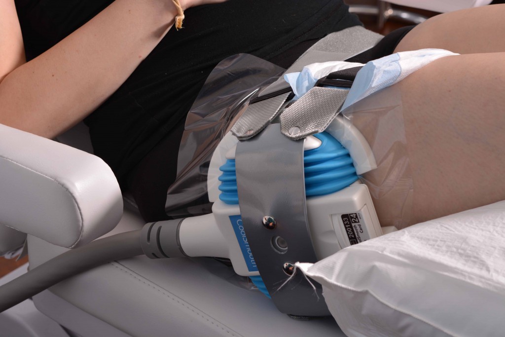 Coolsculpting Erfahrung Wien Zeltiq